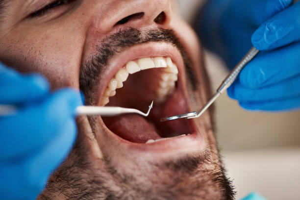 Best Emergency Treatment for Oral Infections in Kingston Springs, TN